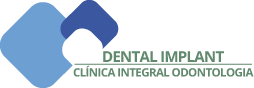 Dental Implant