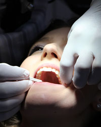 Dental Implant