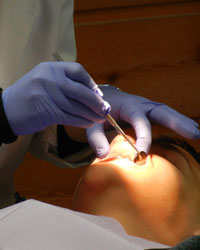 Dental Implant